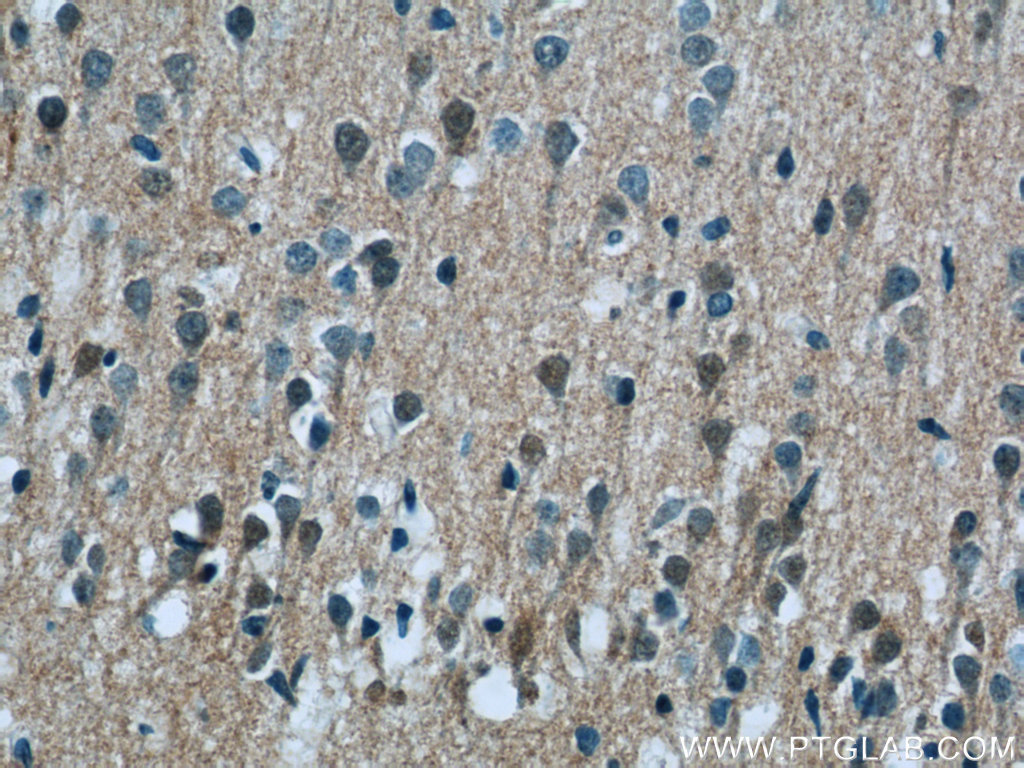 24866-1-AP;human brain tissue