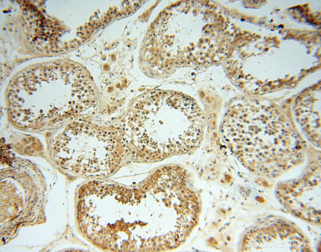 17750-1-AP;H-testis