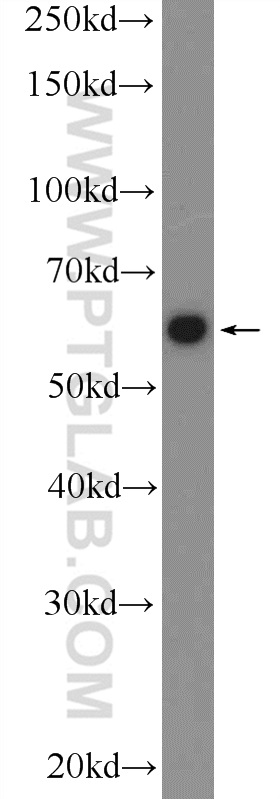 13662-1-AP;HEK-293 cells