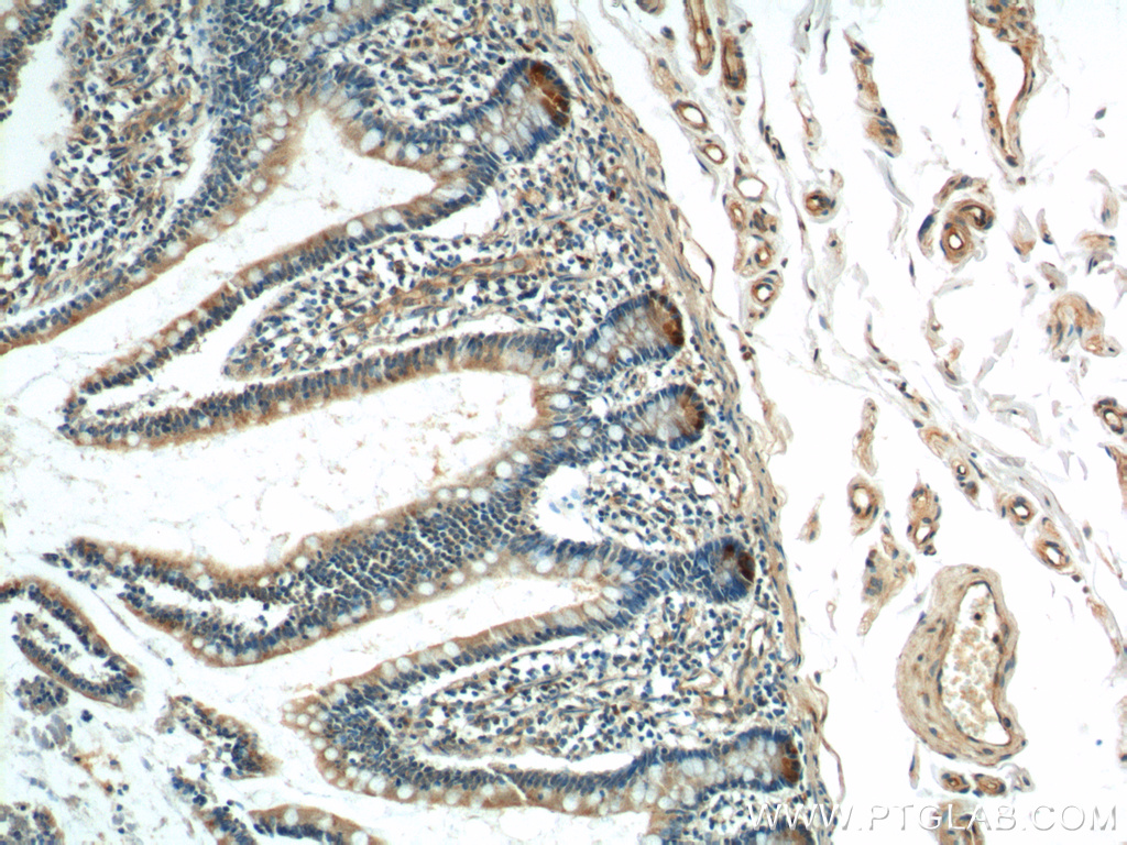 15013-1-AP;human small intestine tissue