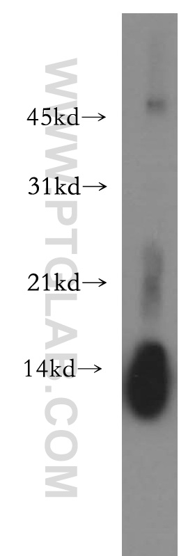 15013-1-AP;human spleen tissue