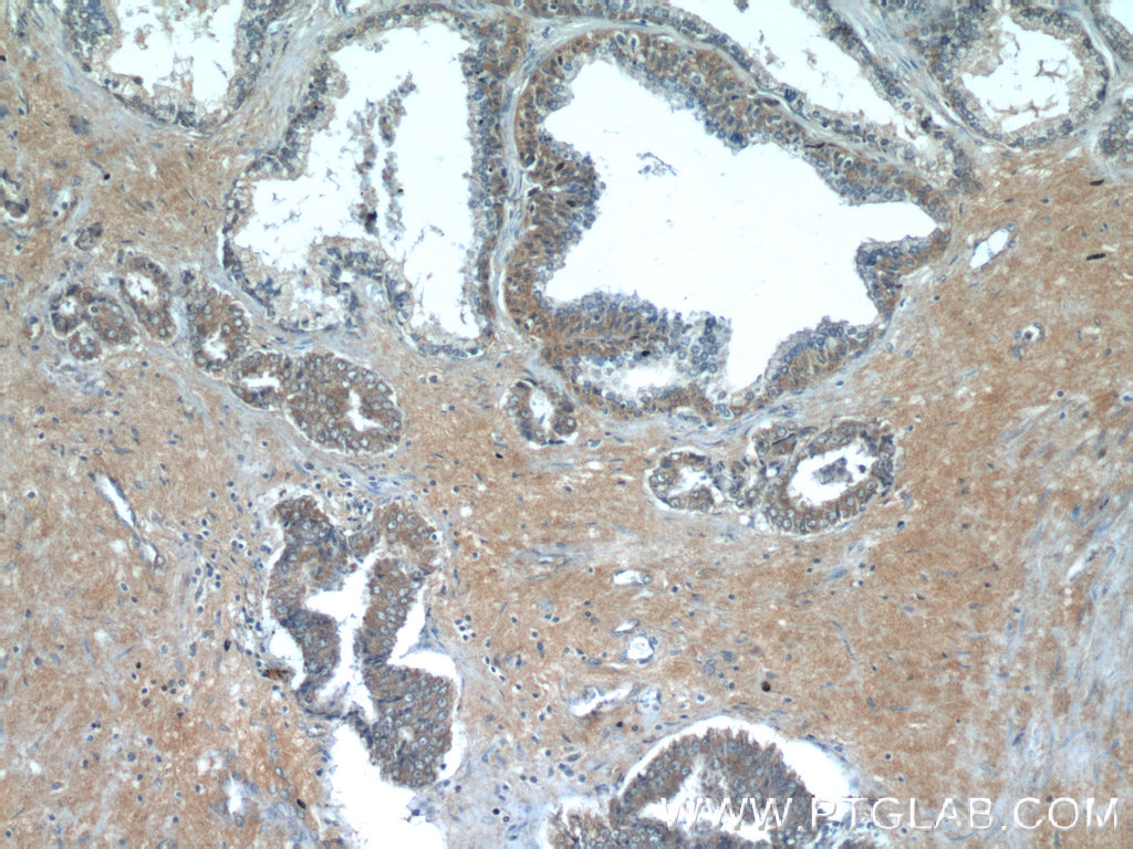 15677-1-AP;human prostate hyperplasia tissue