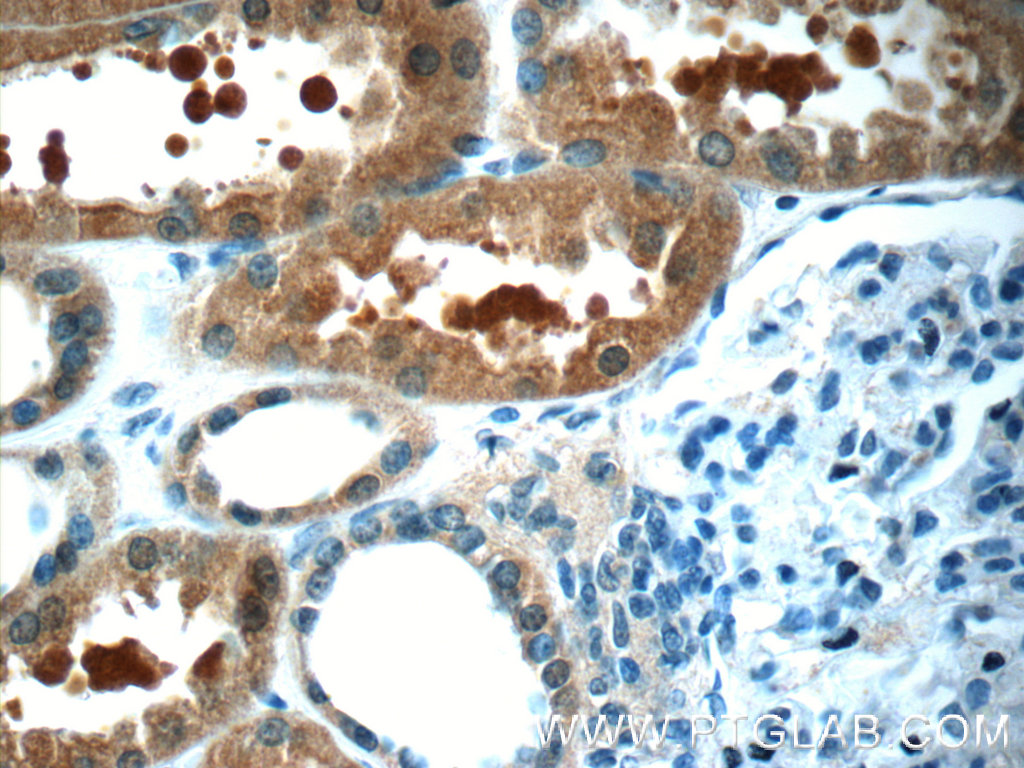 24518-1-AP;human kidney tissue