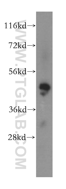 17505-1-AP;HEK-293 cell