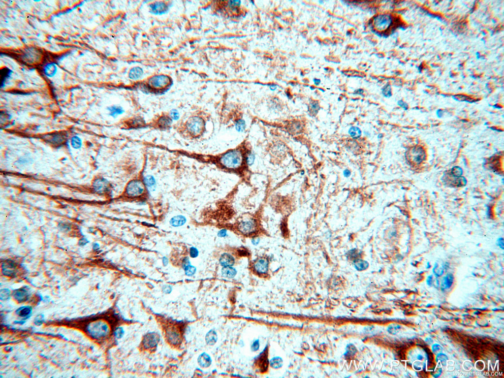17490-1-AP;human brain tissue
