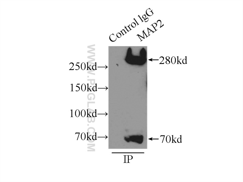 17490-1-AP;mouse brain tissue