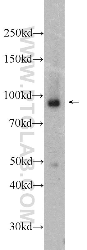 23950-1-AP;Raji cells