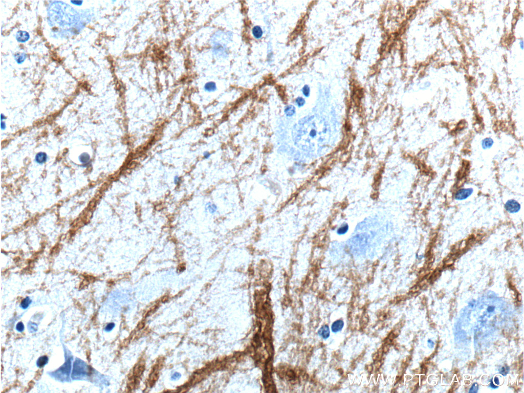 10458-1-AP;human brain tissue