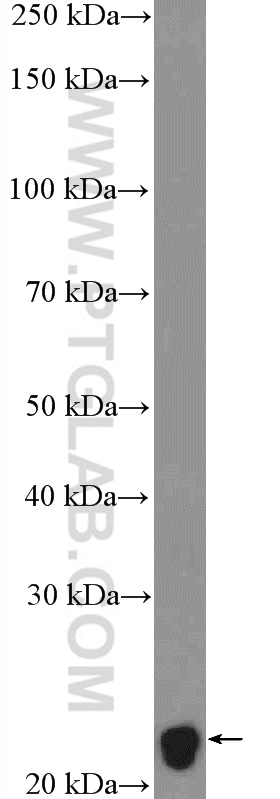 10458-1-AP;mouse brain tissue