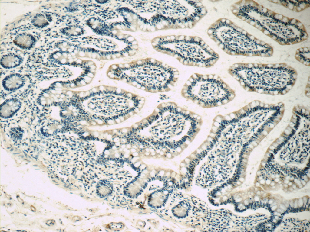 21027-1-AP;human small intestine tissue