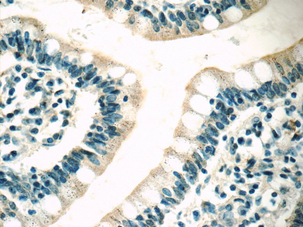 21027-1-AP;human small intestine tissue