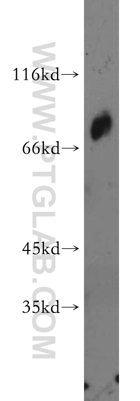 21043-1-AP;mouse ovary tissue