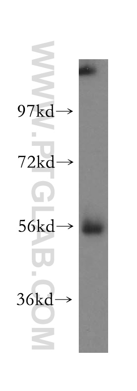 15772-1-AP;human liver tissue