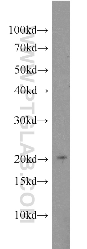 22772-1-AP;HEK-293 cells