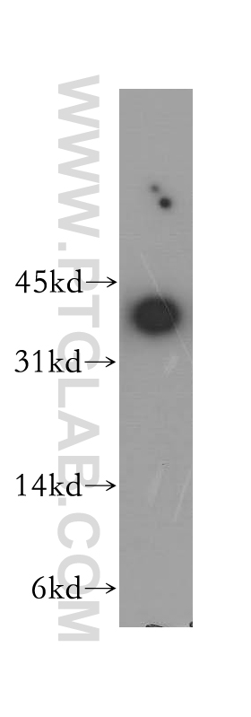 12615-1-AP;HEK-293 cell