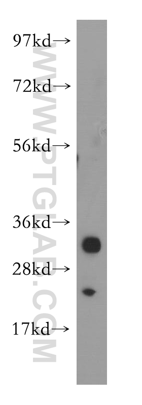 11787-1-AP;Jurkat cell