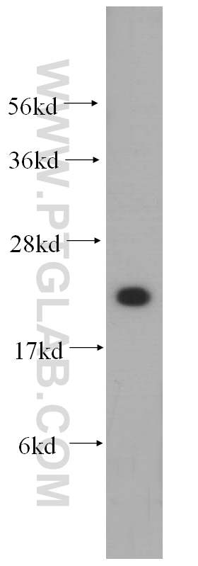 14795-1-AP;HeLa cells