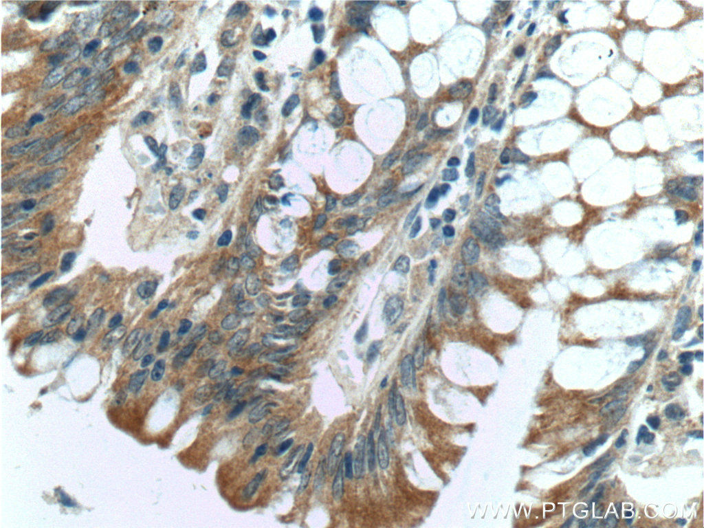15040-1-AP;human colon tissue