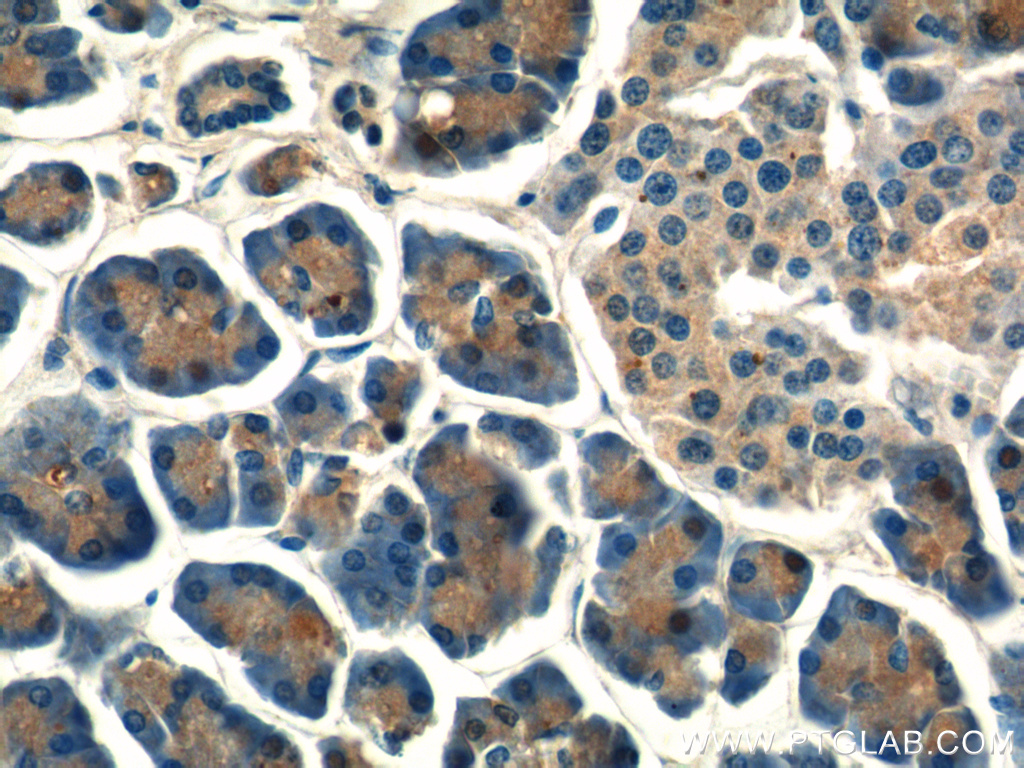 15040-1-AP;human pancreas tissue