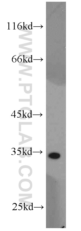 18339-1-AP;MCF7 cell