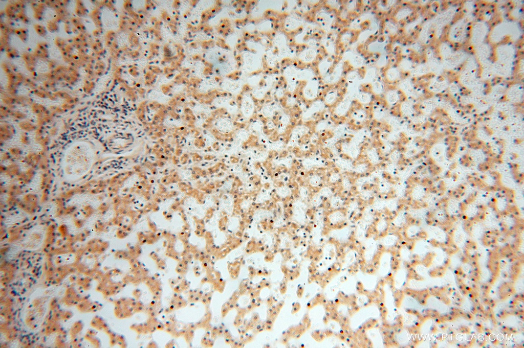 16978-1-AP;H-liver