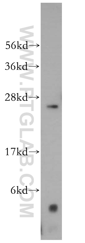 15166-1-AP;HeLa cell