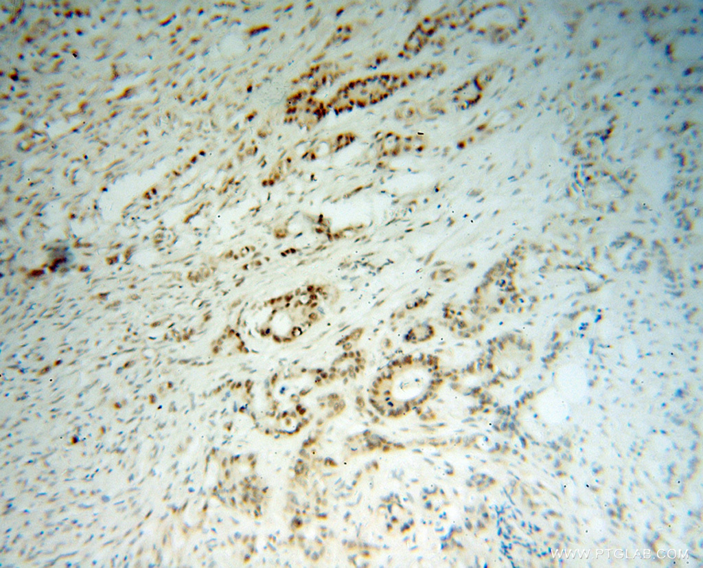 15520-1-AP;human colon cancer