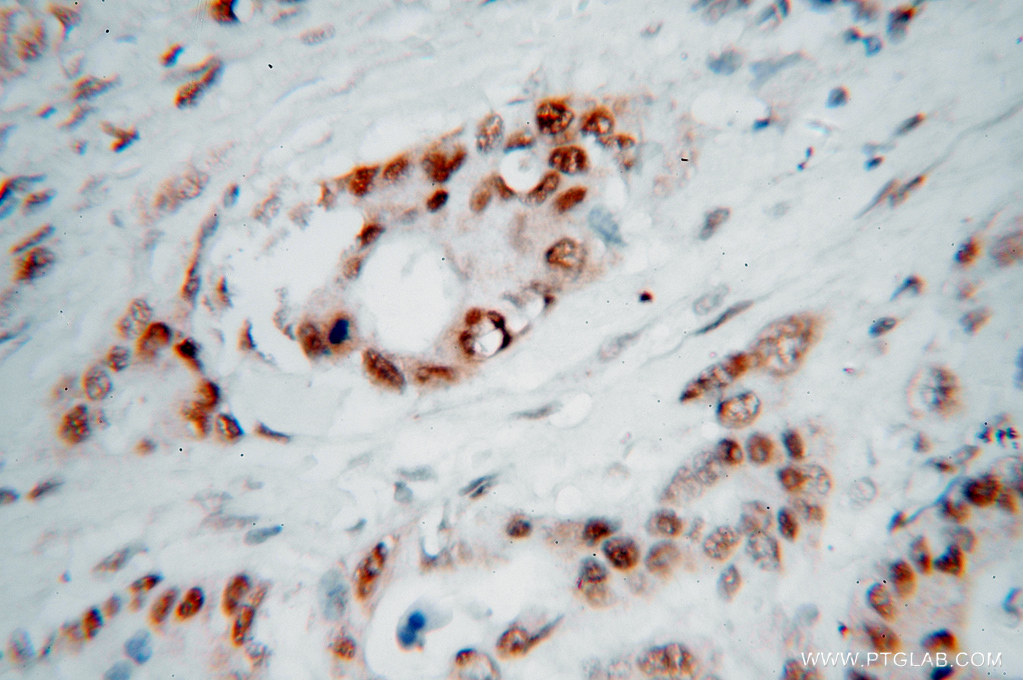 15520-1-AP;human colon cancer
