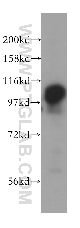 15520-1-AP;HeLa cells