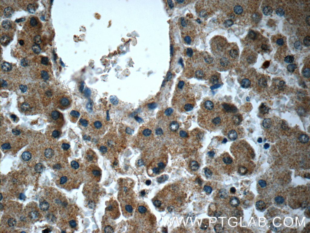 14219-1-AP;human liver tissue
