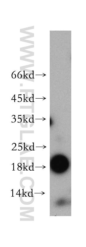 17283-1-AP;mouse heart tissue