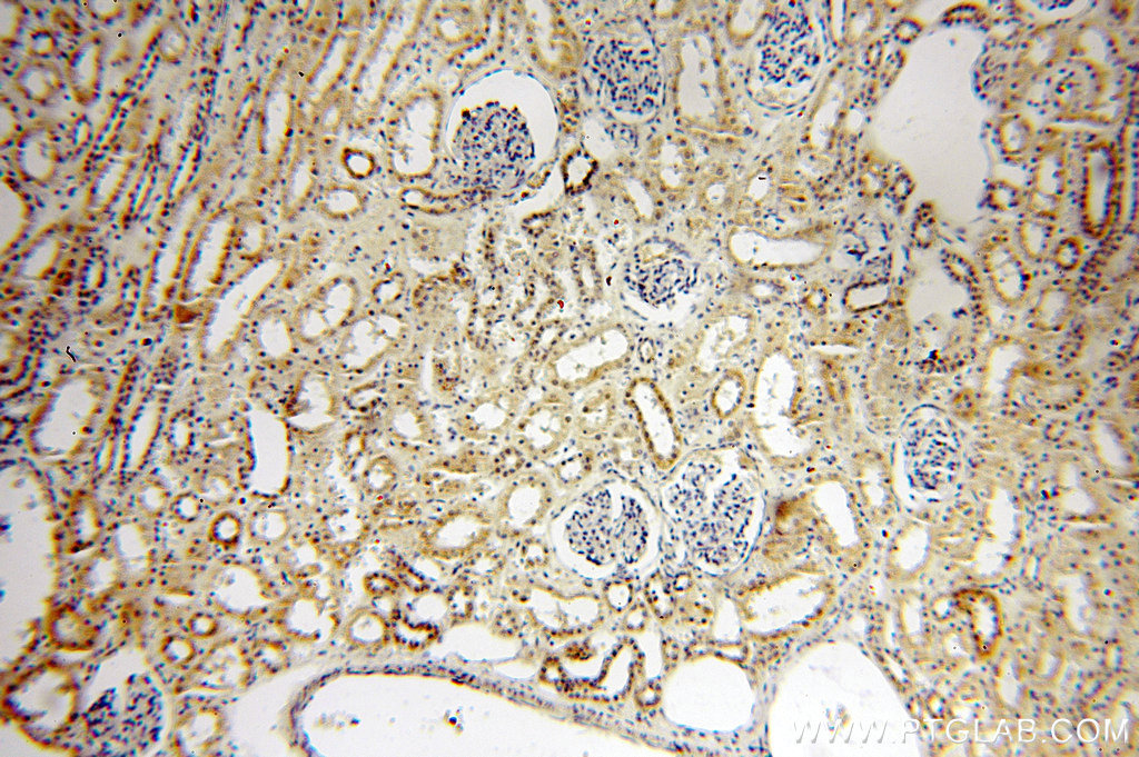 18943-1-AP;human kidney