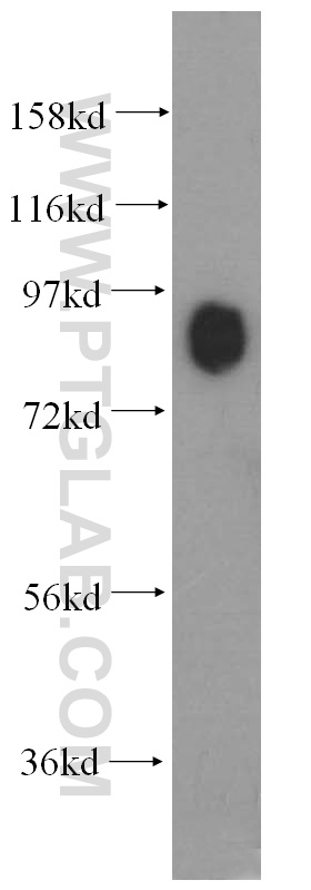 10004-2-Ig;mouse brain tissue