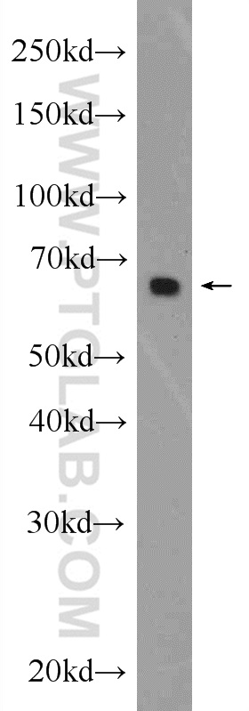 25039-1-AP;HEK-293 cells