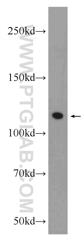 24563-1-AP;HEK-293 cells