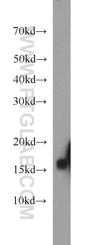 16037-1-AP;mouse skeletal muscle tissue