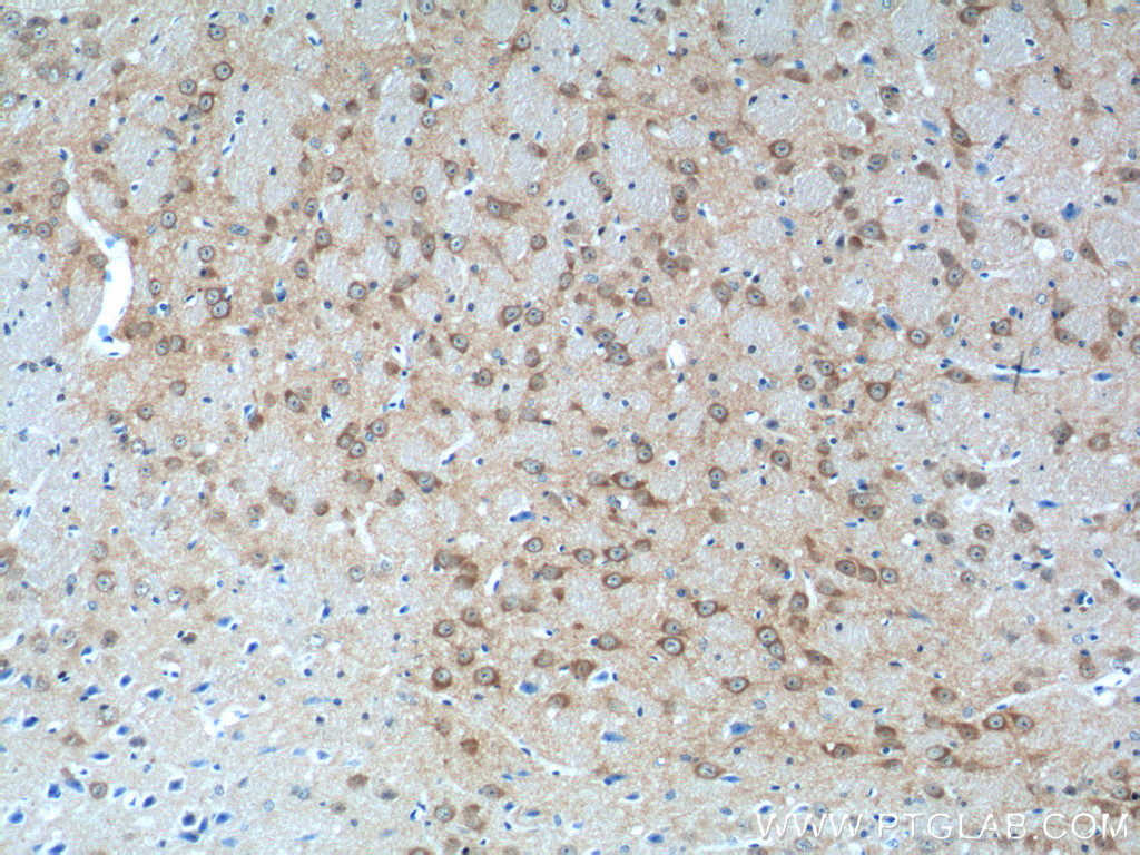 12257-1-AP;mouse brain tissue