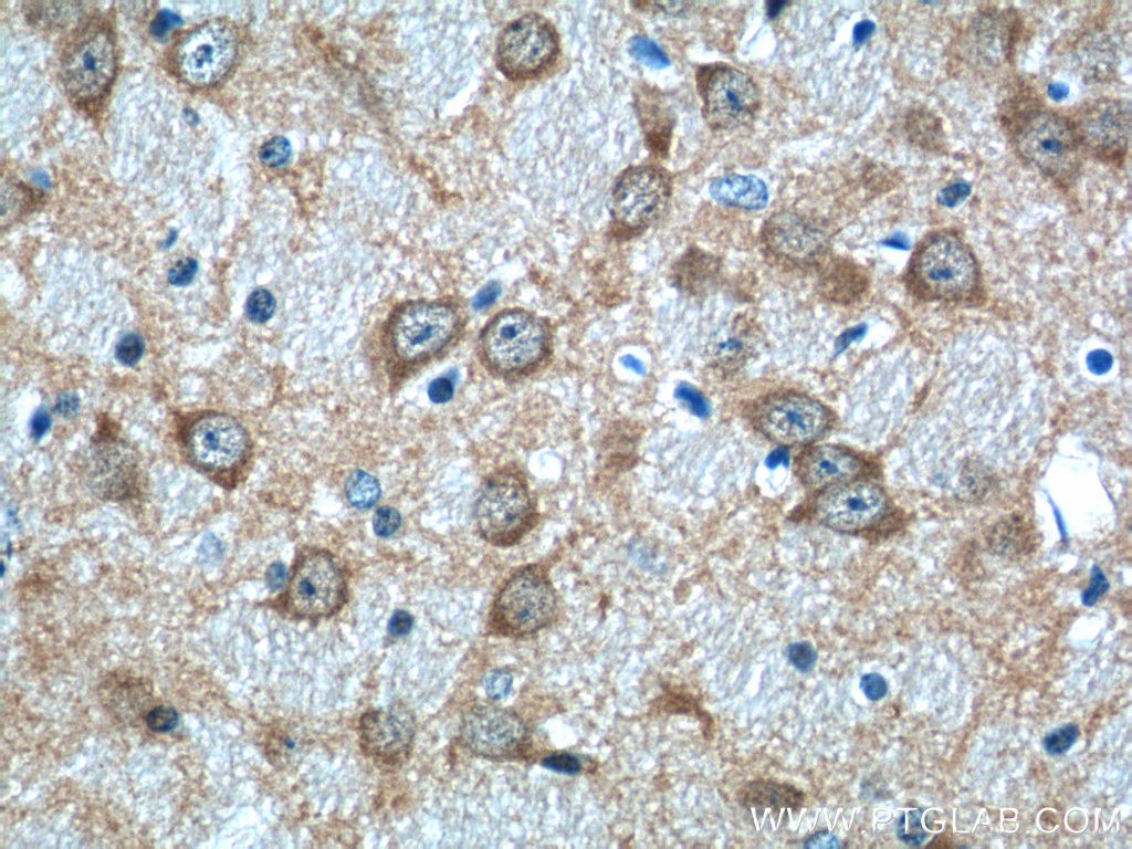 12257-1-AP;mouse brain tissue
