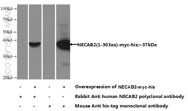 12257-1-AP;Transfected HEK-293 cells