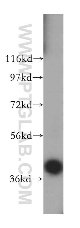 17906-1-AP;human brain tissue