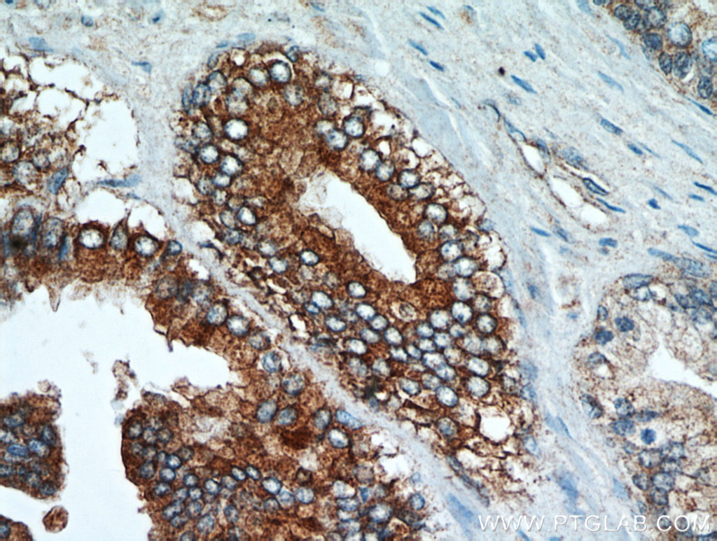 NEDD4L Antibody 136901AP Proteintech