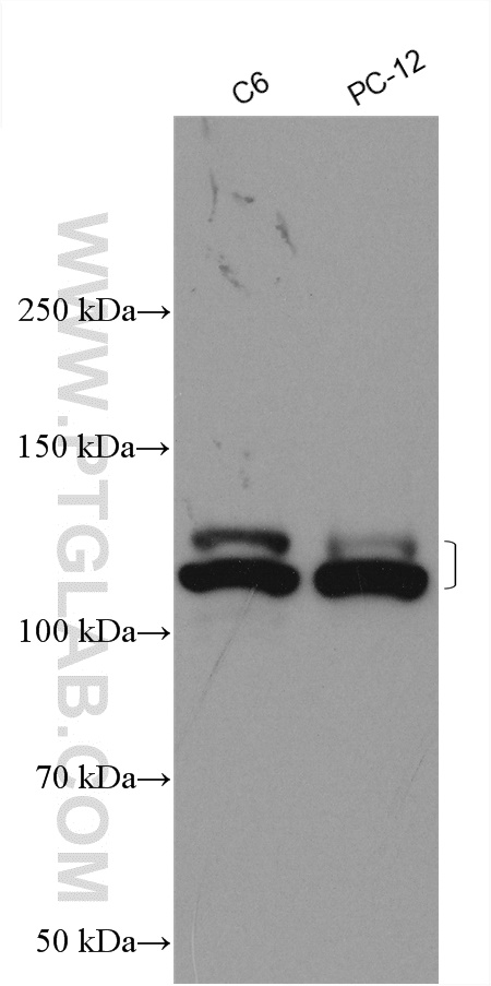 NEDD4L Antibody 136901AP Proteintech
