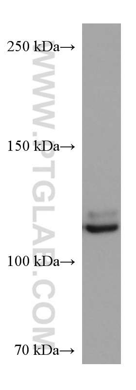 NEDD4L Antibody 672761Ig Proteintech