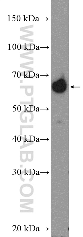 16418-1-AP;BxPC-3 cells