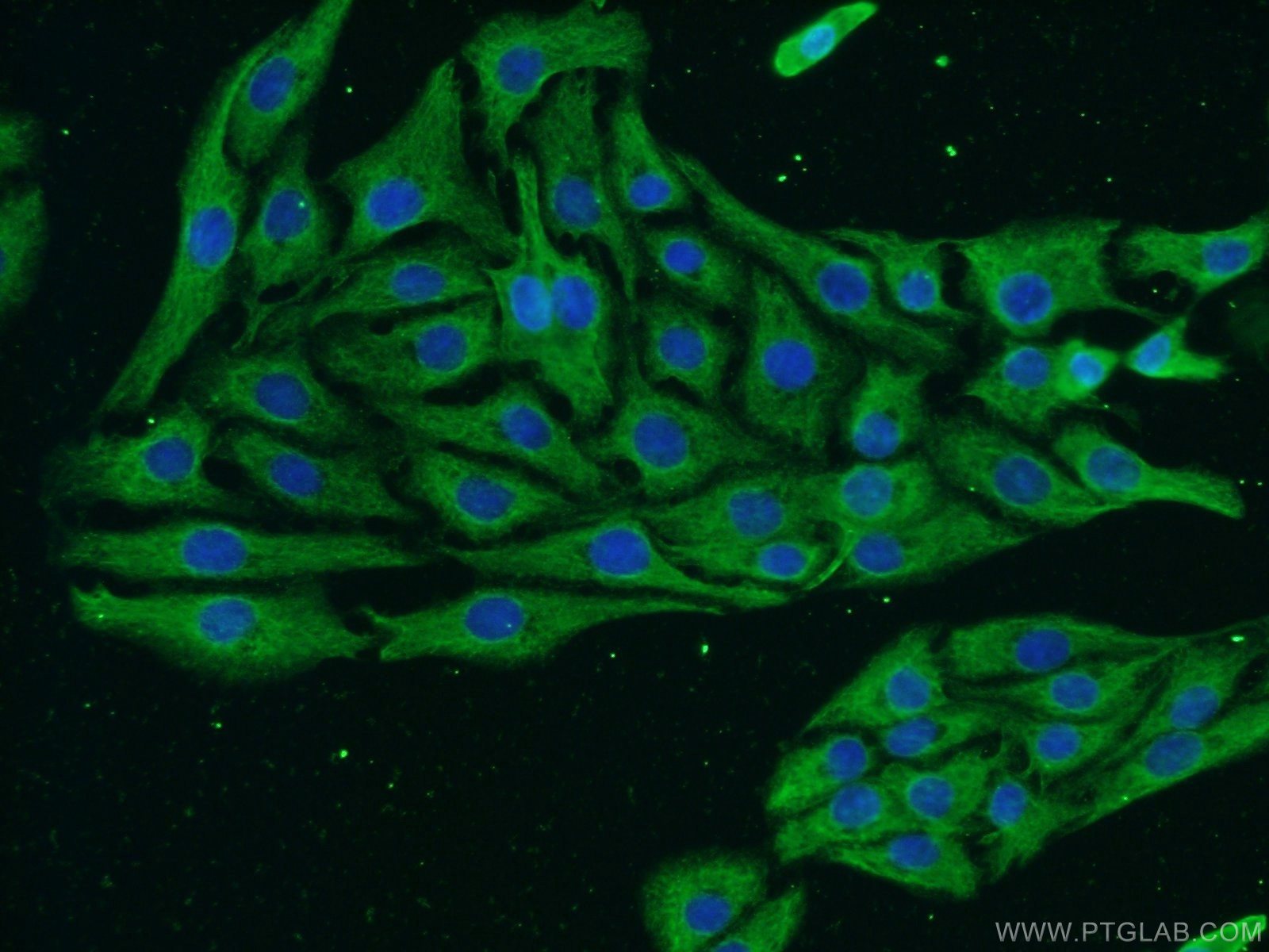 NF-H Antibody 60331-1-Ig | Proteintech