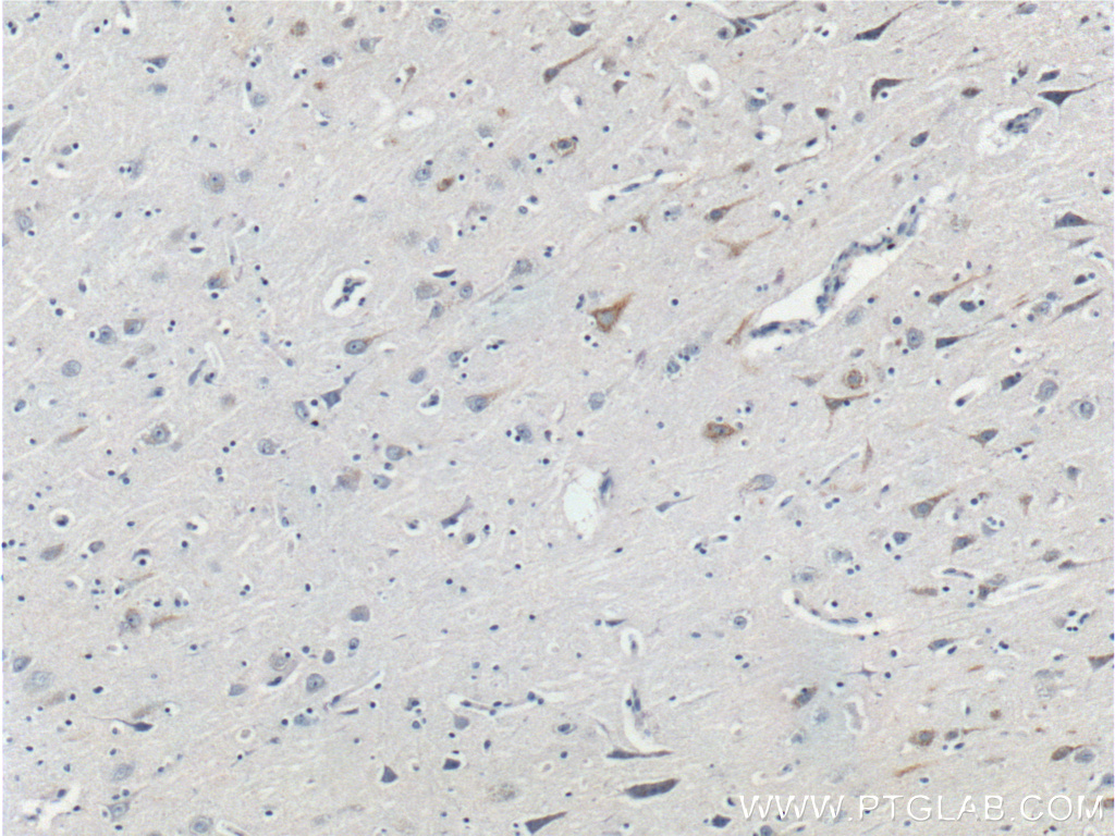 26351-1-AP;human brain tissue