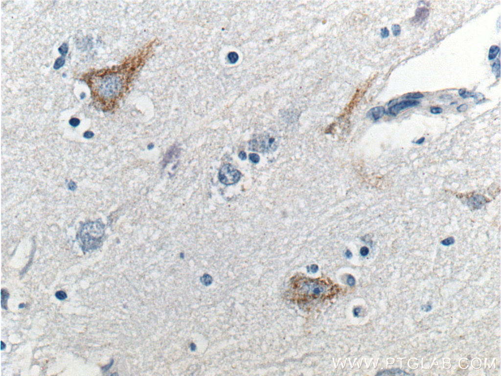 26351-1-AP;human brain tissue