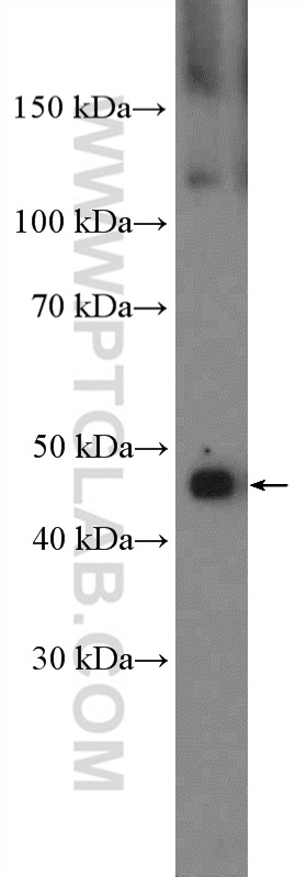 NFKB1 Antibody 142201AP Proteintech