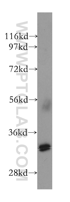 11888-1-AP;human small intestine tissue