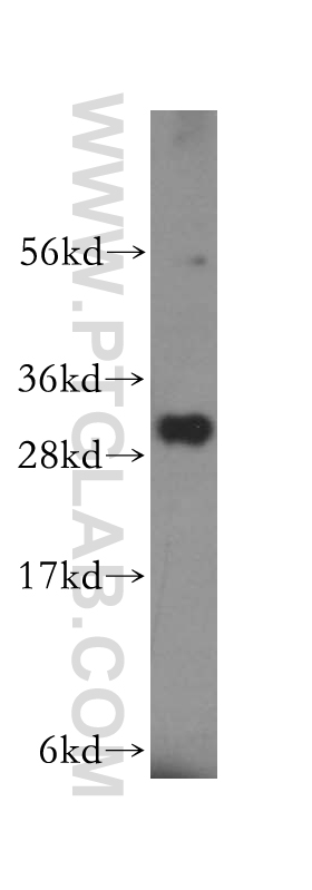 16438-1-AP;human kidney tissue